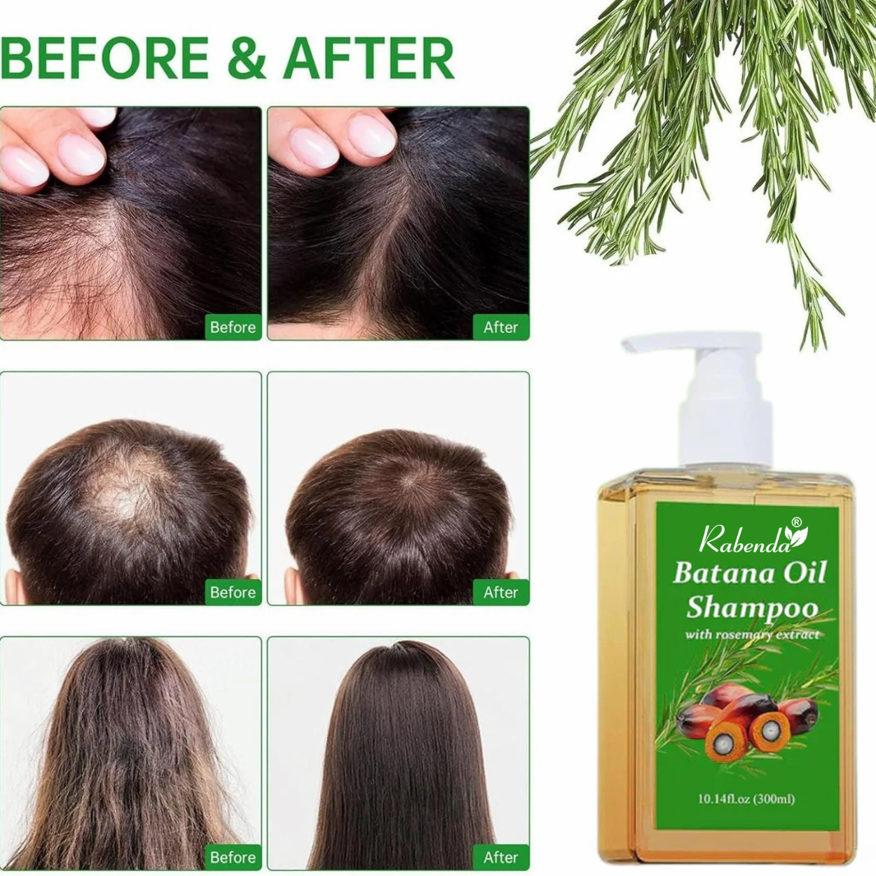 Rabenda® | Batana Oil Shampoo for Male & Female
